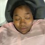 Eyelash Extension Removal