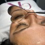 Eyelash Extension Removal