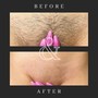 Men’s Brazilian Wax