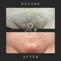 Men’s Brazilian Wax