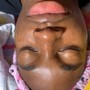 Facial