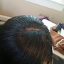 Scalp Treatment