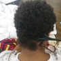 Scalp Treatment