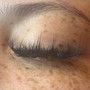 Eyelash Extension Removal