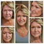 Chemical Peel (starting at $120 depending on peel and strength)