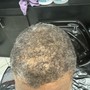 Hairline Waxing