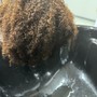 Scalp Treatment