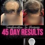 Hair Loss Correction - DIY