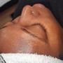 Microdermabrasion Facial