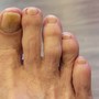 Athlete's Foot Pedicure