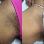 French bikini Wax