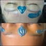 Diamond Dermaplaning