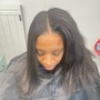 Scalp Treatment