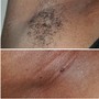 Underarm Wax