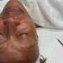 Oxygen Peel Facial