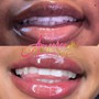 Lip Neutralization