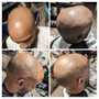 Head Shave