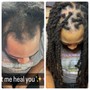 **Loc/Scalp Restore : (Magic Healing For Thinning Roots)**