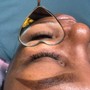 Eyelash Extension Removal