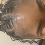 Scalp Detox Treatment