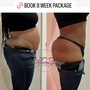 Cavitation + Laser Lipo