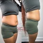 Laser Lipo + Lipo Cavitation + RF skin tightening