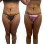 8 Nonsurgical Brazilian Butt Lifts