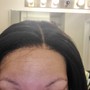 Scalp Treatment