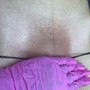 Brazilian Wax