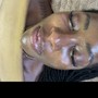 THE GLOW Acne Facial