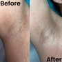 Underarm Wax