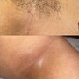 Brazilian Wax maintenance