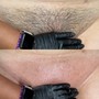 Brazilian Wax