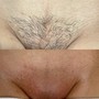 Brazilian Wax