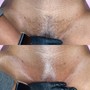 Brazilian Wax