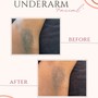 Underarm Wax