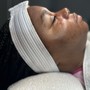 Oxygen Acne Facial