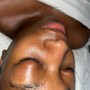 Oxygen Facial