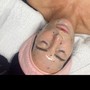 Acne Facial