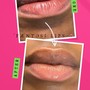 Lips 2.5 ML