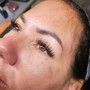 Eyelash Extension Removal