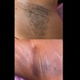 Underarm Wax