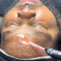 Chin Sugaring