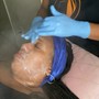 Acne Facial with High Frequency