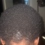 Hair thinning