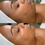 Dermaplaning with Custom Facial