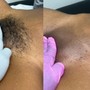 Initial Brazilian Wax