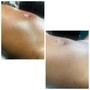 Underarm Wax