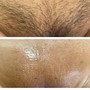 Men’s Chest Wax