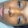 Facial treatment/ microdermabrasion